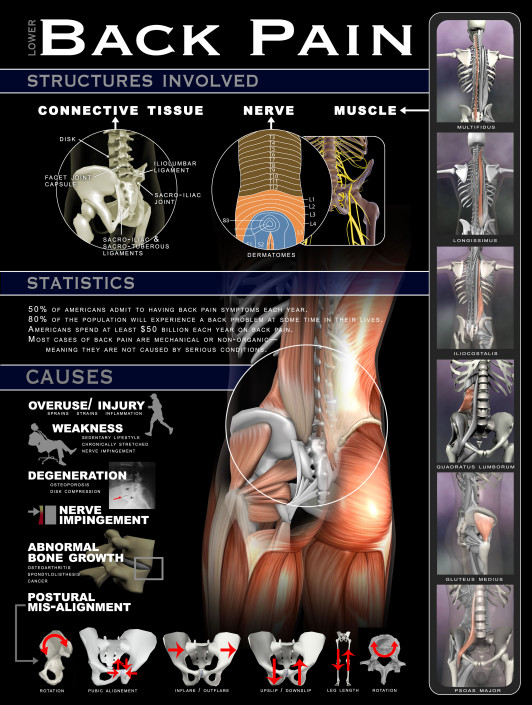 Infographics & Posters Real Bodywork