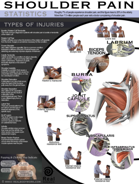 Poster showing various types of shoulder pain