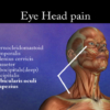 Eye and Head Pain