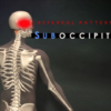 suboccipital muscles referral pain pattern headaches