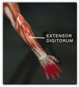 Extensor digitorum muscle