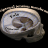 The reciprocal tension membrane