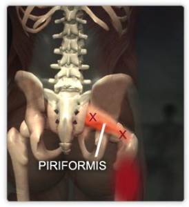 Piriformis muscle