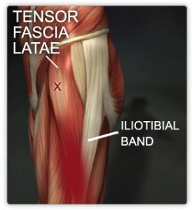 Tensor fascia latae muscle