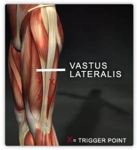 Vastus lateralis muscle
