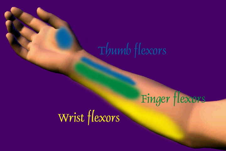 Heal Your Wrist Pain naturally DVD video - Real Bodywork