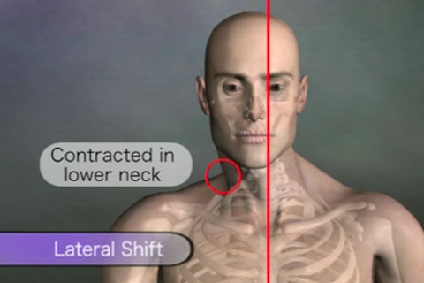 Neck lateral shift assessment