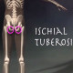 ischial tuberosity