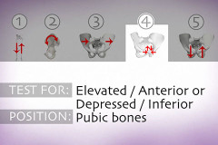 diagram of hip dysfunction